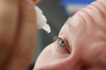 Man with skin allergy digs medical drops into eye