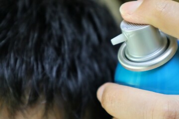 育毛剤を使う日本人男性のクローズアップ