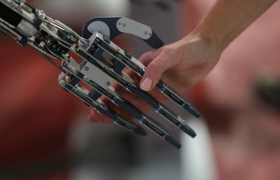 Woman Shaking Hand With Metal Prosthesis Closeup