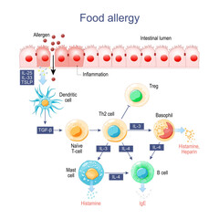 Fototapeta na wymiar Food allergy. Inflammation of Intestine.