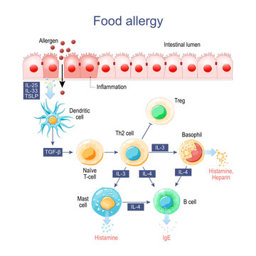 Food allergy. Inflammation of Intestine.