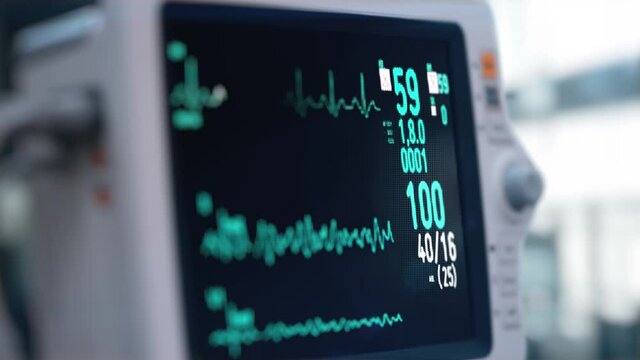 Heart rate monitor in hospital theater. Medical vital signs monitor instrument in a hospital on anesthesia surgery monitor. ECG. Patient heartbeat at the screen