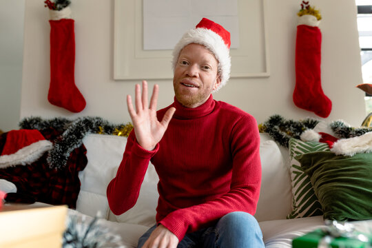 Albino african american man wearing santa hat making video call with christmas decorations - Powered by Adobe