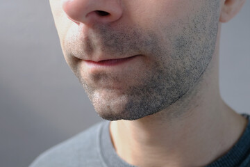 Obraz premium close-up of the lower part of the face, the mouth of a young man 30-35 years old, cosmetology, plastic surgery and beauty concept