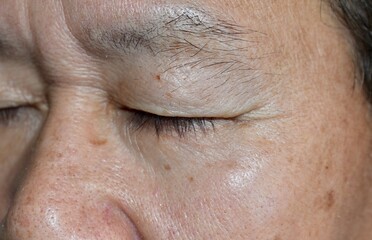 Skin creases around the eye of Asian elder man