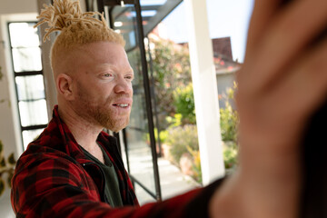 Thoughtful albino african american man with dreadlocks looking out the window