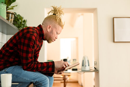 Albino african american man with dreadlocks working from home and using tablet