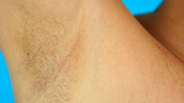 Hairy armpit, isolated on blue background, close-up, unshaven, a lot of hair on armpit