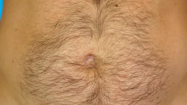 Navel with black hair on white skin. Overweight male body