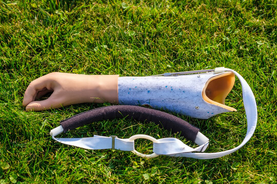 Human hand prosthesis lies on the grass, top view.