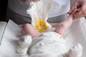 Father changing dirty stinky diaper with yellow poop for his newborn baby