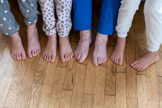 Several pairs of bare feet of people of different ages. Children and grandmothers with sore feet