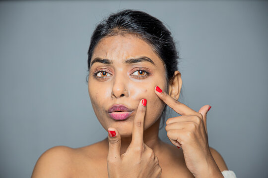Indian Young lady squeezing her pimples, removing pimple from her face. Woman skin care concept