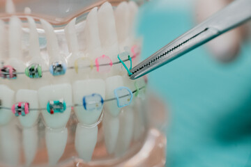 dental model in dentistry orthodontics
