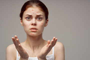 red-haired woman cosmetology skin care puberty light background