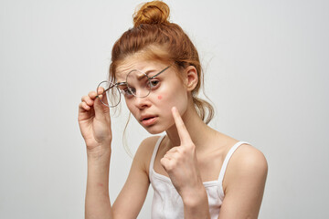 surprised woman with pimple on her face dermatology clean skin treatment