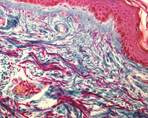 Collagen and elastic fibers. Cajal-Gallego trichrome