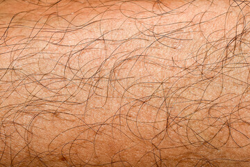 Close-up of human skin surface with black fur.