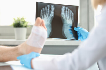 Doctor conducts physical examination of patient with bandaged leg and examines X-ray image