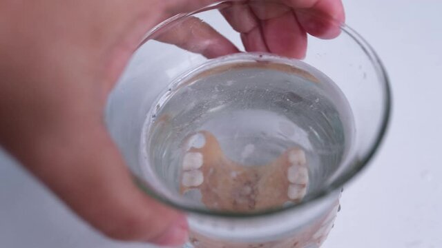 female hand close-up puts partial plastic prosthesis for the upper jaw of a person in glass, disinfecting soluble effervescent tablet lies in water, air bubbles rise