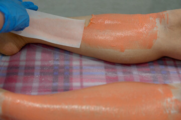 The stage of the epilation procedure.Removal of unwanted hair on the legs.The master removes the wax with the help of special bandage strips for depilation.Orange wax is applied to the legs.
