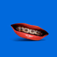 Modern contemporary collage mouth with braces smiling, digital art composition with dental braces