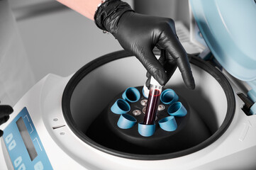 Plasmolifting process. Preparation of blood for injections. Cosmetologist in black rubber glove puts tube of blood in centrifuge. Top view. Concept of beauty and health