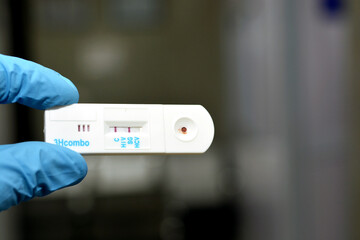 Positive result of Hepatitis B surface antigen and negative HCV and HIV AIDS in a rapid test...