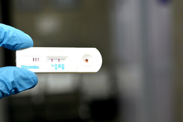 Positive result of Hepatitis B surface antigen and negative HCV and HIV AIDS in a rapid test...