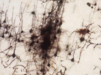 Mouse brain section stained with the Golgi stain, a 19th century technique that was  widely used until recently -  and occasionally still is. Widefield microscopy. Neurons in the cerebral cortex.