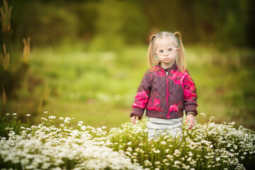 beautiful girl with Down syndrome