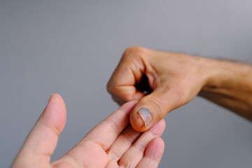 injured male hand close-up, thumb finger injury accident, bruise on fingernail, concept of a safety violation, first aid, violation of labor protection at work
