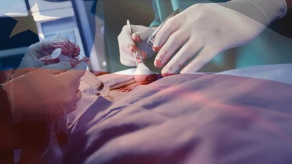 Animation of flag of chile over surgeons in operating theatre - Powered by Adobe