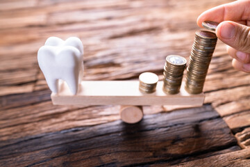 Dental Tooth Implant Cost