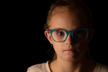 portrait of a girl with Down syndrome