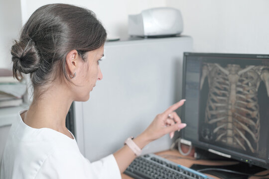 middle east woman doctor looking at monitor with chest bones computer tomography image and pointing at details. female young radiologist discussing ct test results.