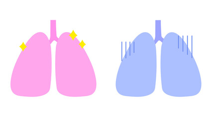 効果の付いているシンプルな肺のイラスト。健康なものと不健康なもの。