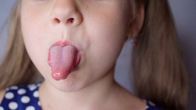 girl opens her mouth wide and pulls out long tongue. child shows his teeth and mouth to dentist. mouth is wide open, tongue is stuck out as far as possible, with clear view of tongue and soft palate