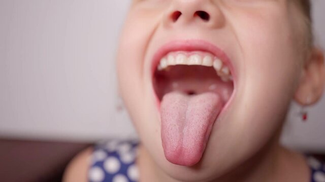 girl opens her mouth wide and pulls out long tongue. child shows his teeth and mouth to dentist. mouth is wide open, tongue is stuck out as far as possible, with clear view of tongue and soft palate