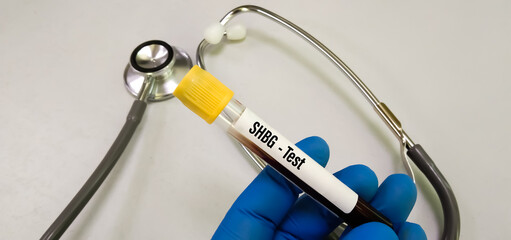 Blood sample for sex hormone binding globulin or SHBG test, diagnosis of abnormal testosterone level