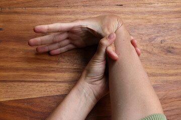 A woman demonstrating joint hyper mobility in her hands.
