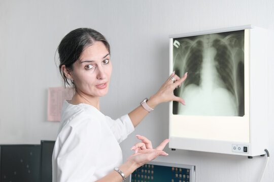 woman radiologist pointing to the screen with x-ray image of lungs and talking or discussing case with viewer. coronavirus and lung disease sequelae.