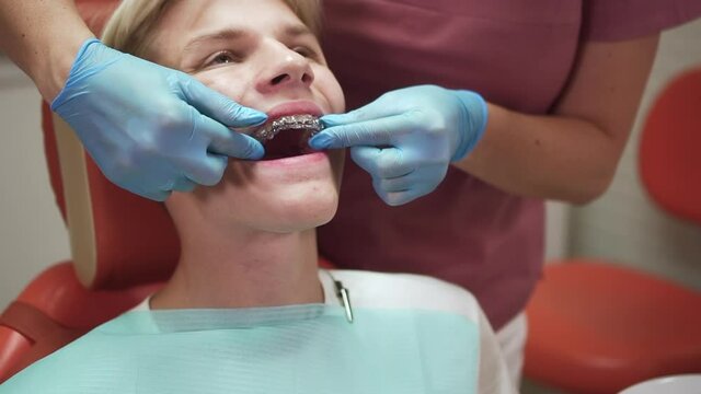 Female orthodontist inserting mouthguard into mouth of patient during visit at modern clinic spbd. Closeup view of woman doctor puts transparent model on teeth of teenager and stands next to him, he