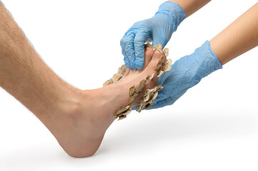 A doctor in rubber gloves examines a patient's foot with foot fungus, white isolated background,...
