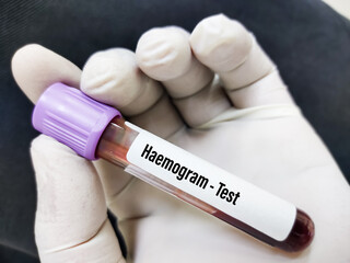 Blood sample tube for Haemogram or Complete Blood Cell (CBC) test