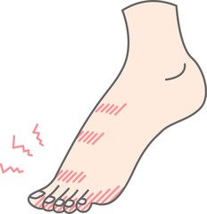 足のしもやけのイラスト