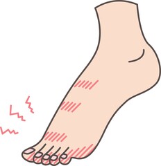 足のしもやけのイラスト