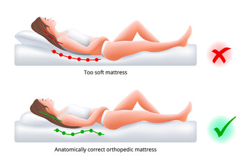 Choosing an orthopedic mattress for sleeping - Correct and incorrect sleeping position on back, vector illustration.