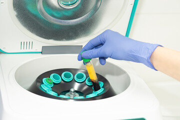 A hand in a blue medical glove pulls out a test tube with blood plasma from the centrifuge. soncept of laboratory blood tests and cosmetological injections of beauty of skin and hair. - obrazy, fototapety, plakaty