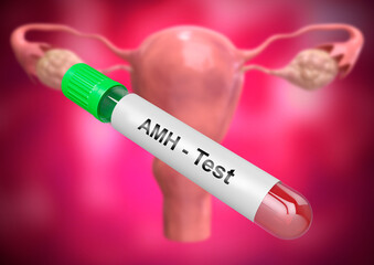 Blood sample tube for anti-Müllerian hormone or AMH test, evaluate of ovarian function and fertility in woman - obrazy, fototapety, plakaty